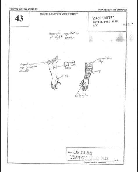 gigi autopsy sketch|Kobe Bryant, Gigi Autopsy Sketch Photos Cause。